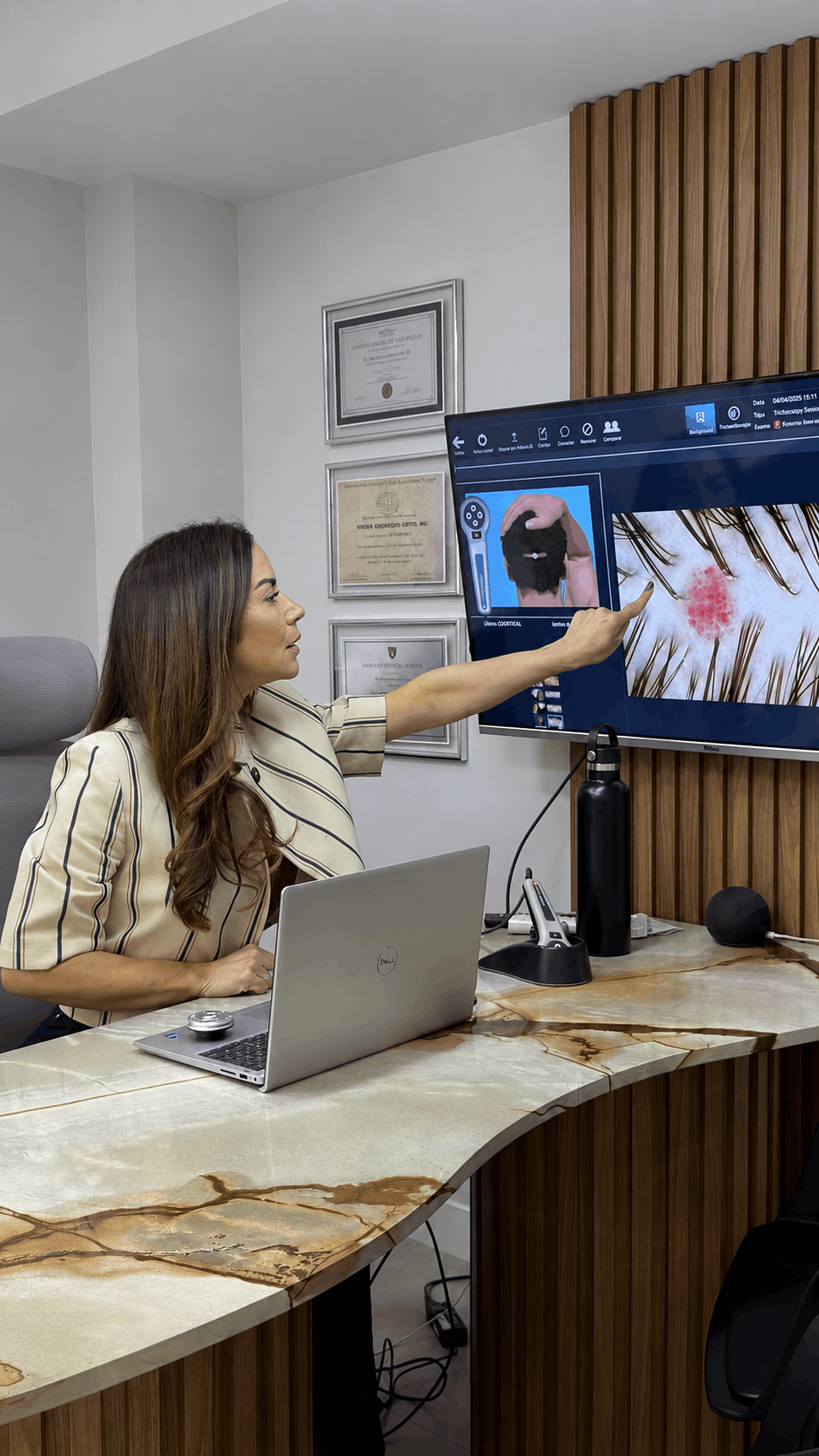 Dra. Ludmila Vieira explicando um exame de tricoscopia digital na tela, em consultório
